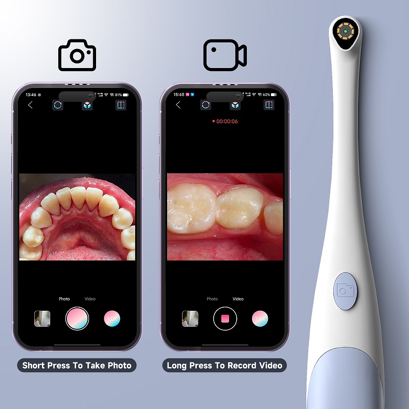 Telecamera Endoscopica Orale 1 - Photography Lighting Continuous recensione e prezzo