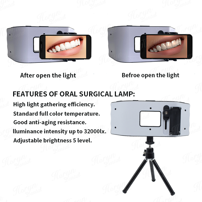 Luce flash dentale Attrezzatur - Photography Lighting With Flash recensione e prezzo